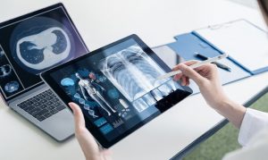Do 2034 roku wartość rynku AI w medycynie ma osiągnąć bilion dolarów